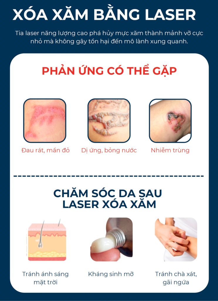 XÓA XĂM BẰNG LASER Tia laser năng lượng cao phá hủy mực xăm thành mảnh vỡ cực nhỏ mà không gây tổn hại đến mô lành xung quanh.