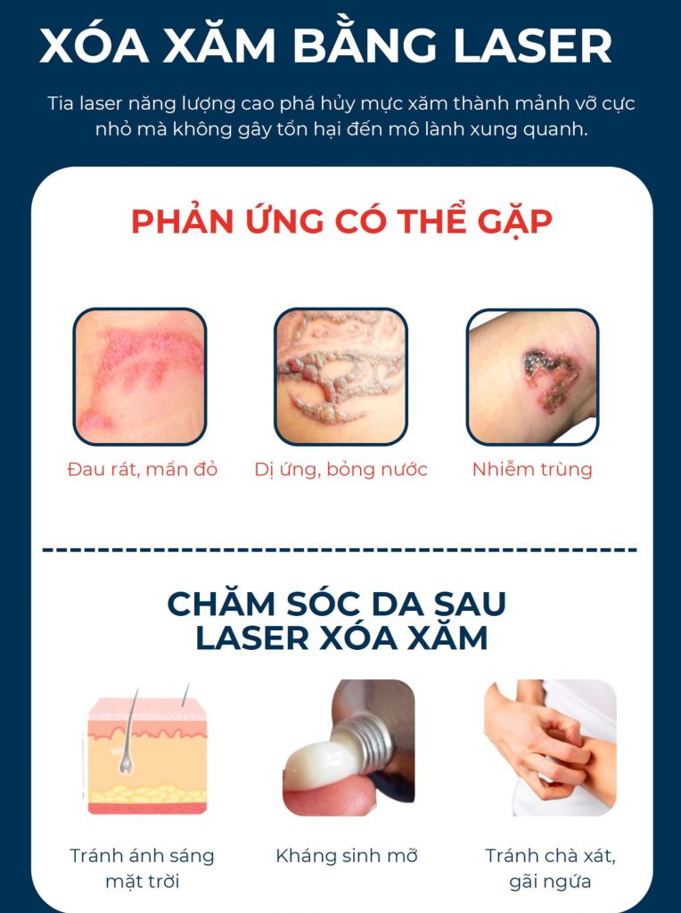 XÓA XĂM BẰNG LASER Tia laser năng lượng cao phá hủy mực xăm thành mảnh vỡ cực nhỏ mà không gây tổn hại đến mô lành xung quanh.